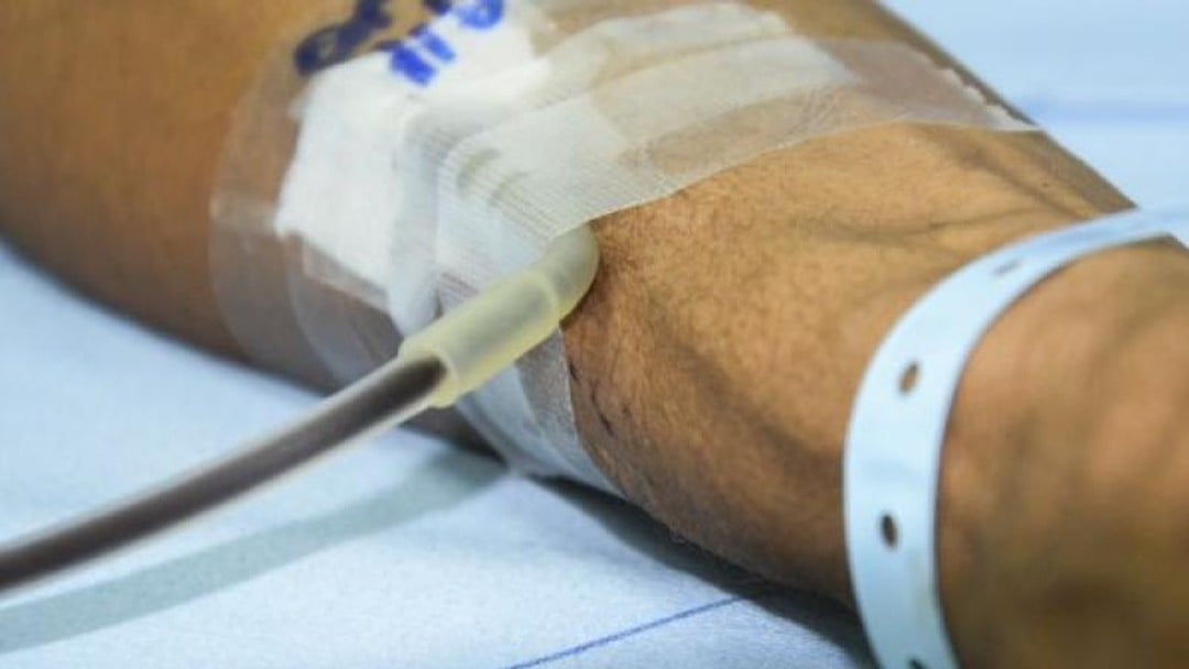 The first act of a costs saga