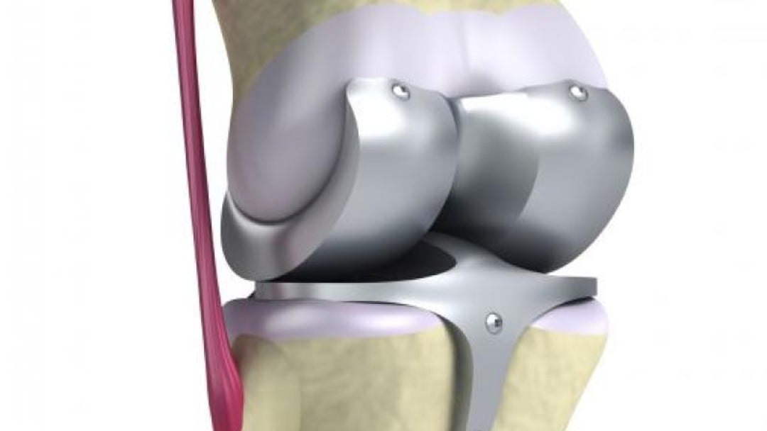 The ever-increasing cost of prosthetic limbs